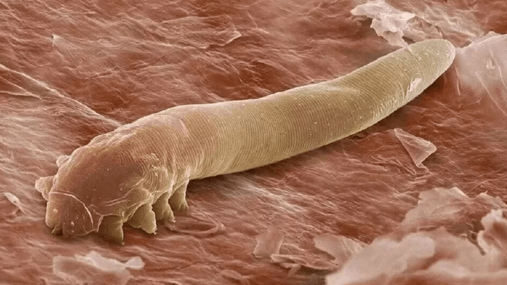 Parásitos en el cuerpo humano