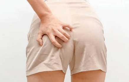 Anal