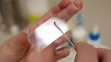Análisis de Calais para identificar parásitos