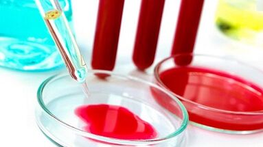 Análisis de sangre para parásitos