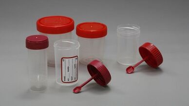 Cómo prepararse para la prueba de parásitos