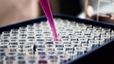 Cómo tomar pruebas para la detección de parásitos en el cuerpo