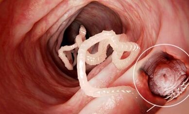 cómo reconocer la presencia de parásitos en los intestinos humanos